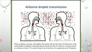 مقدمات بیماری های تنفس جلسه 9