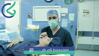 رویای چهره زیبا با عمل بینی| دکتر علی بصام جراحی بینی