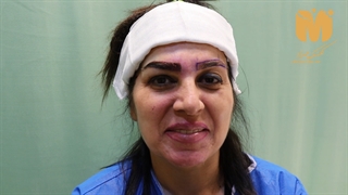ویدیو کاشت ابرو کلینیک مهرزاد