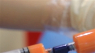 فیلم تزریق چربی به روش نانوفت