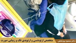 کاهش زمان ارتودنسی با لیزر کم توان