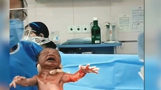 فیلم اتاق عمل زایمان سزارین ملودی جون