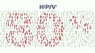 زگیل تناسلی