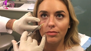 آموزش تزریق ژل زیر چشم بلوترو