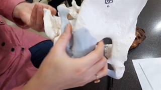 مفصل های لگن . عملی پزشکی