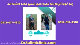 تجربیات کسانی که عمل اسلیو معده انجام داده اند