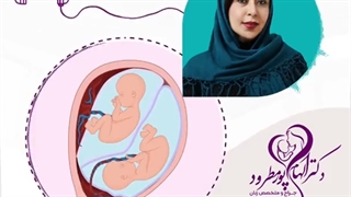موضوع : جفت پایین