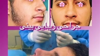 جراحی زیبایی بینی