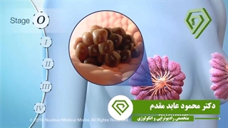 شایع ترین عوامل ابتلا به سرطان پستان