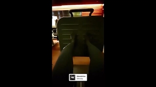 جنجال همسر سپهر حیدری لیپوساکشن