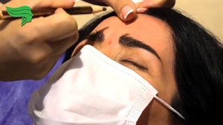 تزریق بوتاکس به پیشانی جوانسازی پوست