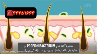 چرا جوش می زنیم جرمگیری