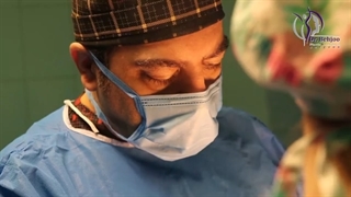 عوامل موثر در پیری صورت