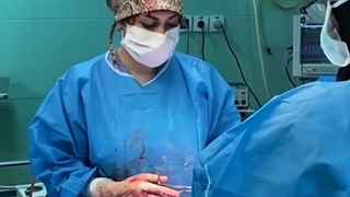 جراحی سزارین