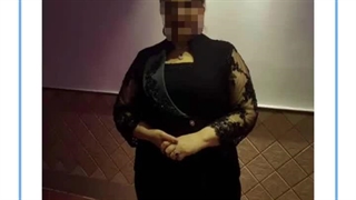 تصاویر قبل و بعد از عمل چاقی