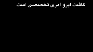 کاشت ابرو تخصصی