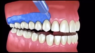 بلیچینگ آفیس