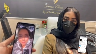 رضایت مشتری بعد از گذشت یک سال از کاشت ابرو