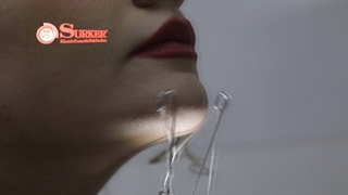 بند انداز سورکر رو می شناسید؟