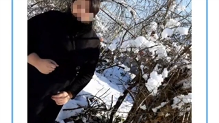 تصاویر قبل و بعد از عمل چاقی