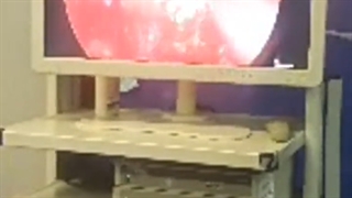 ارتباط بین بیماری آسم و بیماری های گوش، حلق و بینی