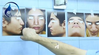 فیلم بلافاصله بعد از عمل