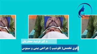 جراحی بینی مردانه