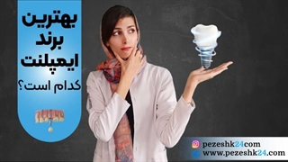 بهترین نوع ایمپلنت در ایران (بهترین برند ایمپلنت چیست؟)