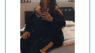 تصاویر قبل و بعد از عمل چاقی