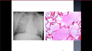 پاتولوژی عمومی جلسه 7