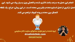 کدام جراحی لاغری مناسب شماست