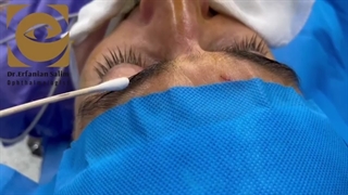 جراحی خارج کردن تومور چشم