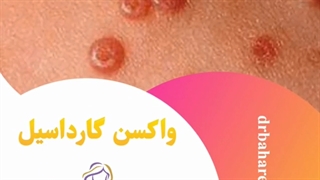 چرا واکسن گارداسیل بزنیم؟