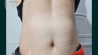 نتیجه استفاده 5 جلسه از دستگاه LDM