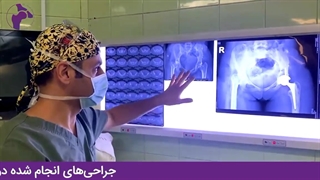 جراحی تعویض مفصل در کودکی و جراحی مجدد در بزرگسالی