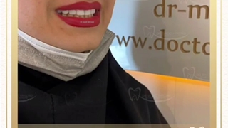 از بین بردن فاصله بین دندانی و گذاشتن کامپوزیت