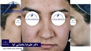 جراحی زیبایی بینی