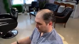 ترمیم موی داماد کم مو09126074167