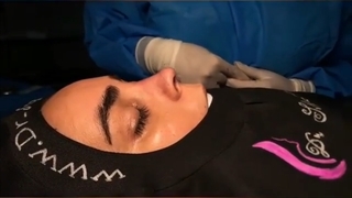 بلافاصله بعد از عمل بینی