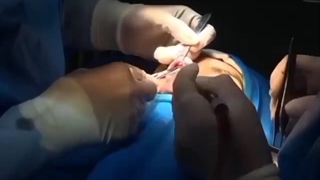 فیلم جراحی ترمیمی بینی در اتاق عمل