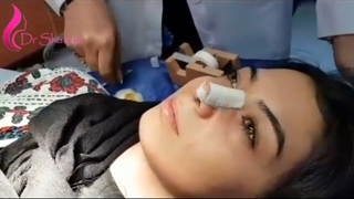 نحوه چسب زدن بینی