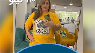 تصاویر قبل و بعد از عمل اسلیو معده