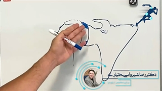 اهمیت ترمیم لبروم شانه| دکتر شیروانی بختیاری