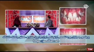 ارتودنسی درمان است یا عمل زیبایی / متخصص ارتودنسی / دکتر جمیلیان