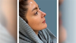 جراحی زیبایی بینی
