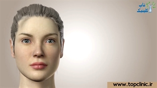 نحوه جراحی بینی عقابی