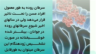 علائم سرطان روده