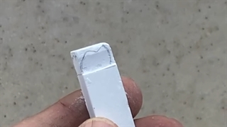 بخش دوم دندان مولر پایین