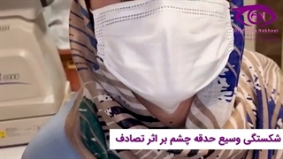 شکستگی وسیع حدقه چشم بر اثر تصادف