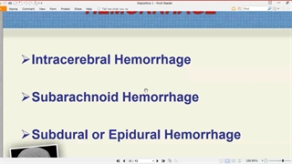 نورولوژی جلسه 3
